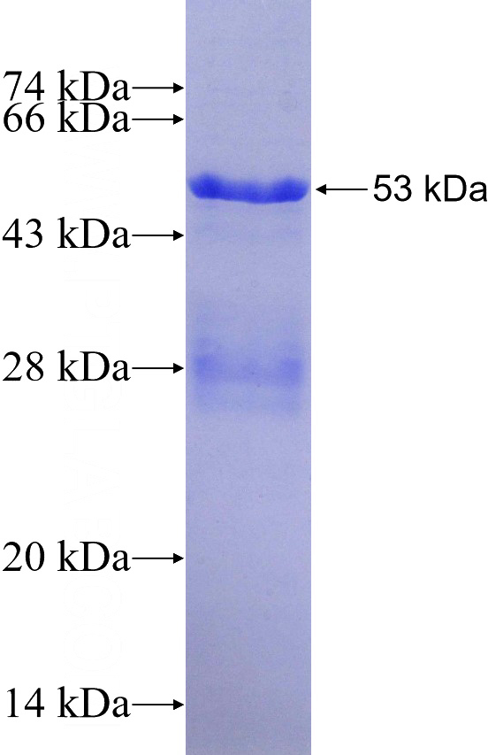 Recombinant Human HNF4A SDS-PAGE
