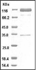 Influenza A H5N1 (A/VietNam/1203/2004) Hemagglutinin / HA Protein (His & Fc Tag) SDS-PAGE