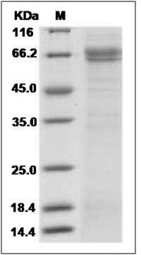 Human SUSD4 / Sushi domain-containing Protein 4 Protein (Fc Tag) SDS-PAGE