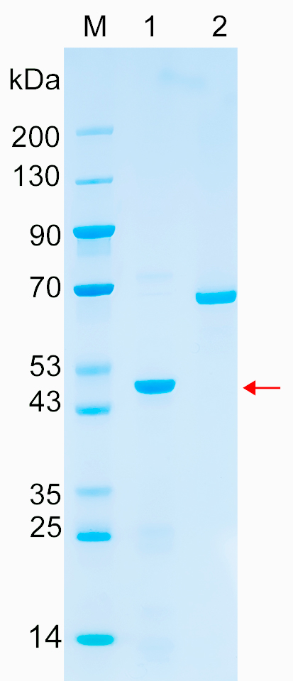 Recombinant KIF2C protein (His tag) SDS-PAGE