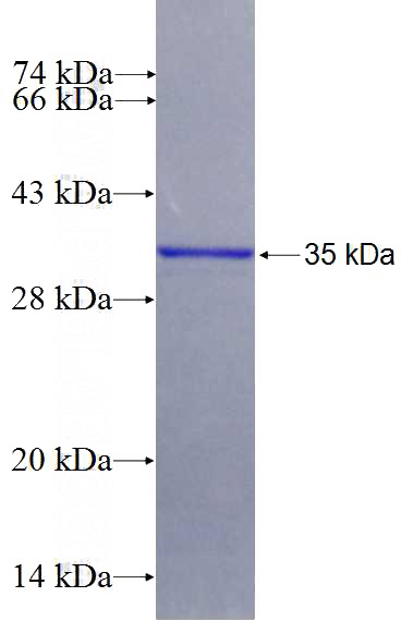 Recombinant Human CYP4F2 SDS-PAGE