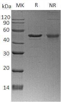 Human NDRG1/CAP43/DRG1/RTP (His tag) recombinant protein