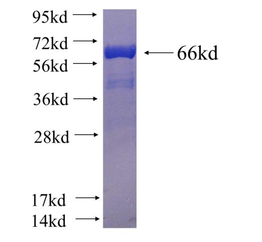 Human TMOD3 Recombinant protein (GST tag)