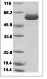 Human HAAO / 3-HAO Protein 15335