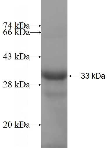 Recombinant Human PCOLCE SDS-PAGE
