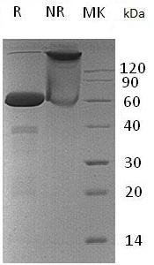 Human VSIG8/C1orf204 (Fc tag) recombinant protein