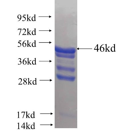 Recombinant human RPL11(Full length) SDS-PAGE