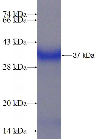 Recombinant Human TOR1A SDS-PAGE