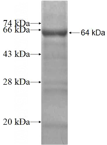Recombinant Human PRPF19 SDS-PAGE