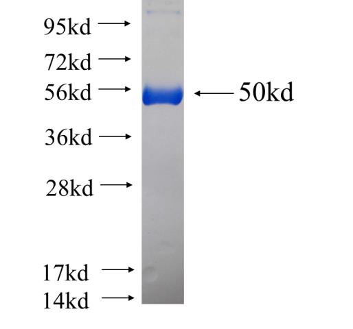 Recombinant human OVCA2(Full length) SDS-PAGE