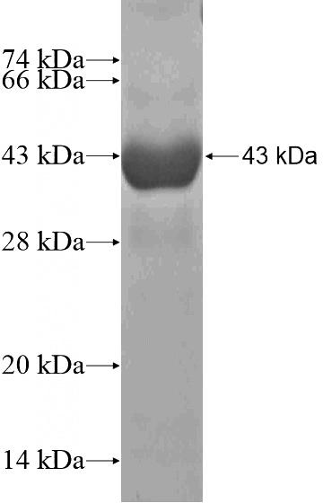 Recombinant Human CCDC141 SDS-PAGE