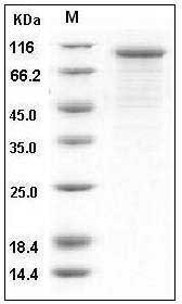 Human Cadherin-6 / CDH6 Protein (His Tag) SDS-PAGE