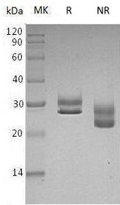 Human F11R/JAM1/JCAM/UNQ264/PRO301 (His tag) recombinant protein