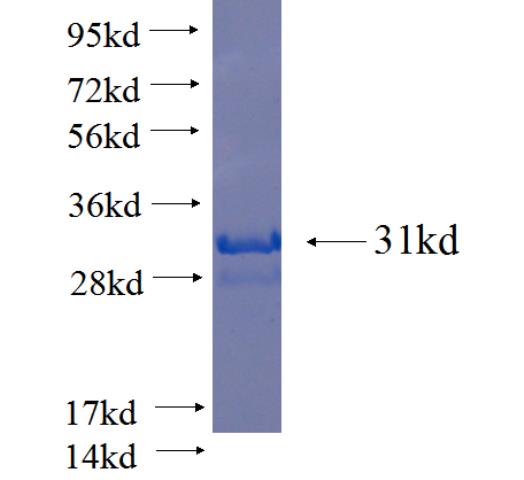 Recombinant human GPR87 SDS-PAGE