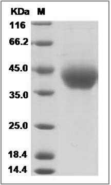 Mouse B7-H3 / CD276 Protein (His Tag) SDS-PAGE