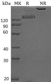 Human ERBB2/HER2/MLN19/NEU/NGL (Fc tag) recombinant protein