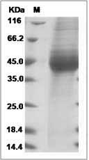 Cynomolgus IL17BR / IL17RB / IL-17 Receptor B Protein (His Tag)