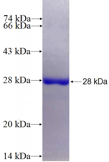 Recombinant Human OPHN1 SDS-PAGE