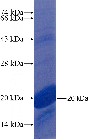 Recombinant Human C12orf59 SDS-PAGE