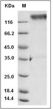 Rat LAMP1 / CD107a Protein (Fc Tag) SDS-PAGE