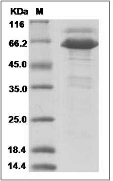 Mouse EphB6 Protein (His Tag) SDS-PAGE