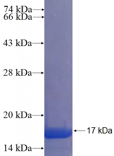 Recombinant Human C6orf226 SDS-PAGE