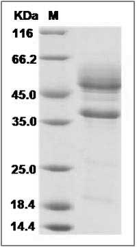 Human PRAP1 / Proline-rich acidic Protein (Fc Tag) 1 Protein (Fc Tag) SDS-PAGE
