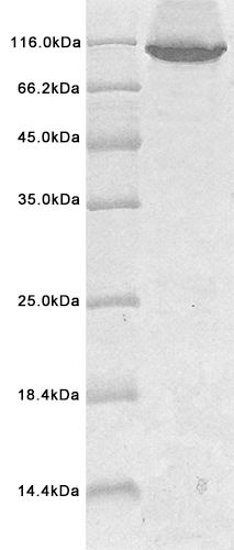 Recombinant Human UHRF1 protein