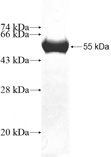 Recombinant Human ENOPH1 SDS-PAGE