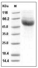 Human IL22BP / IL22RA2 Protein (His Tag) SDS-PAGE