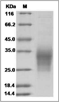 Human IL-31 / IL31 Protein (His Tag) SDS-PAGE