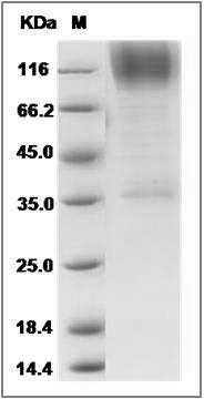 Human B3GNT2 Protein (Fc Tag) SDS-PAGE