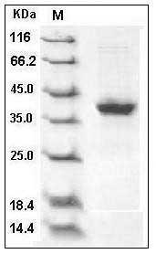 Human S100A2 Protein (Fc Tag) SDS-PAGE