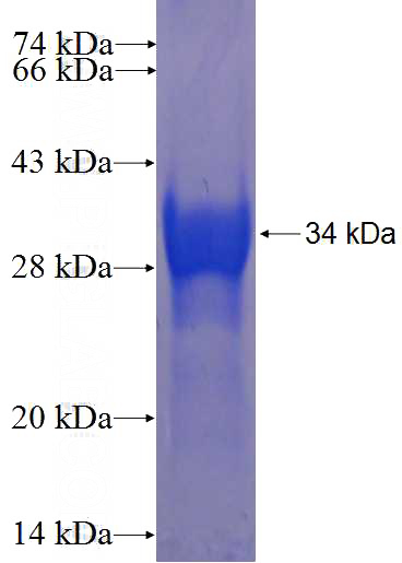 Recombinant Human PDS5B SDS-PAGE