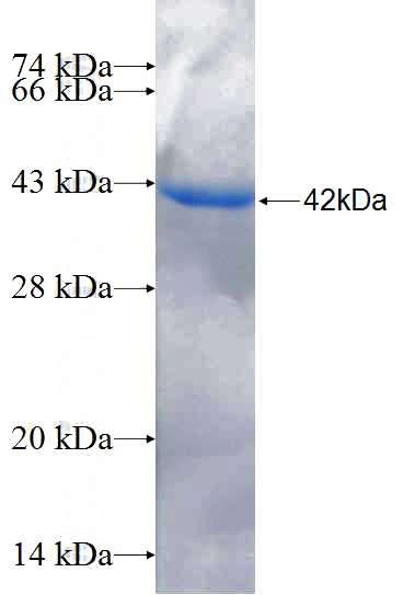 Recombinant Human DBNDD2 SDS-PAGE