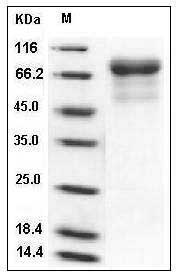 Influenza A H5N1 (A/Hong kong/213/03) Hemagglutinin / HA Protein (28 Ser/Trp, His Tag) SDS-PAGE