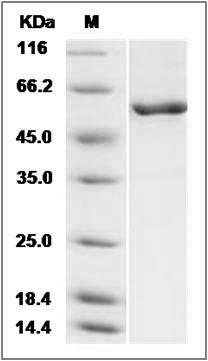 Mouse CAMK4 / CaMKIV Protein SDS-PAGE