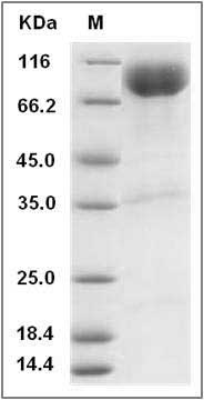 Cynomolgus IL23R / IL23 Receptor Protein (Fc Tag) SDS-PAGE