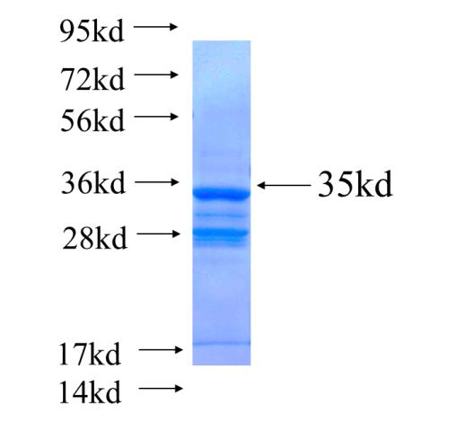 Recombinant human HMGN2(Full length) SDS-PAGE