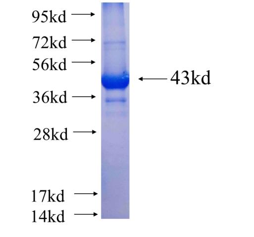 Recombinant human CLTC SDS-PAGE