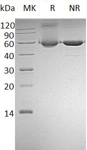 Human ALDH1A1/ALDC/ALDH1/PUMB1 (His tag) recombinant protein