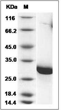 Schistosoma japonicum Glutathione S-transferase / GST Protein SDS-PAGE
