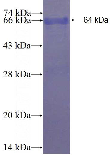 Recombinant Human C2orf39 SDS-PAGE