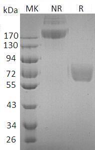 Human IL4R/IL4RA/582J2.1 (Fc tag) recombinant protein