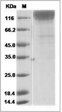 Simian immunodeficiency virus (SIV) (isolate 216.94.A2) gp120 Protein (His Tag)