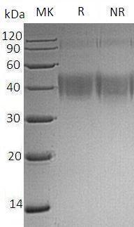 Human CD200/MOX1/MOX2/My033 (His tag) recombinant protein