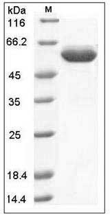 Human EPOR / Erythropoietin Receptor Protein (Fc Tag) SDS-PAGE