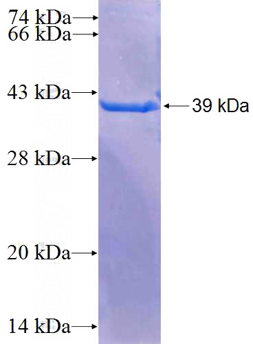 Recombinant Human RBL2 SDS-PAGE