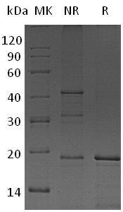 Human TNFSF10/APO2L/TRAIL (His tag) recombinant protein