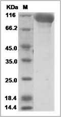 Hendra virus (HeV) (isolate Horse/Autralia/Hendra/1994) Glycoprotein Protein (Fc Tag)